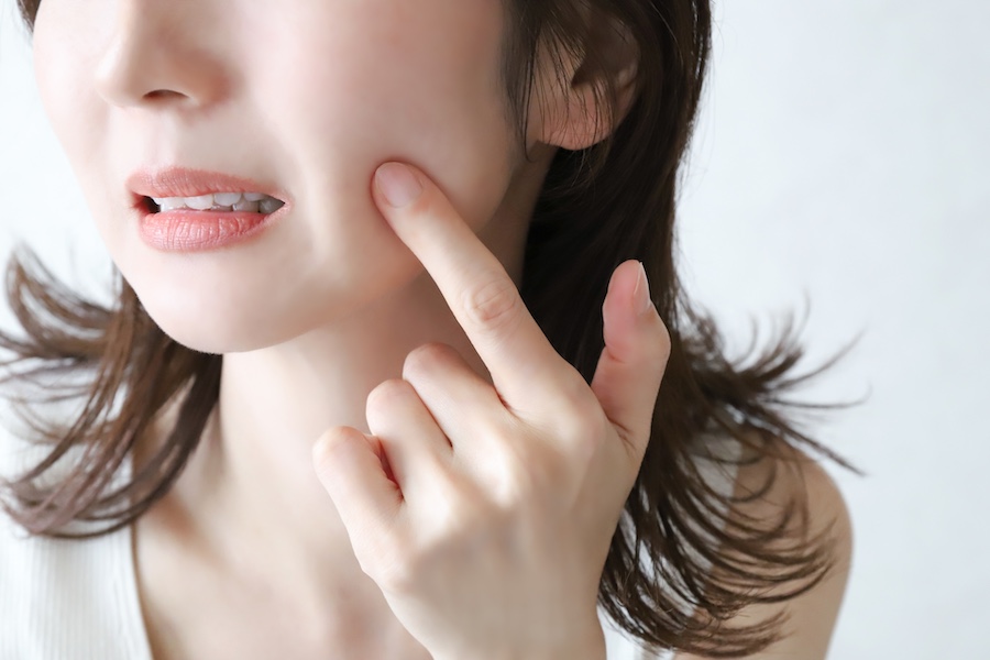 美容鍼が実はニキビの救世主である理由とその仕組みを徹底解説！